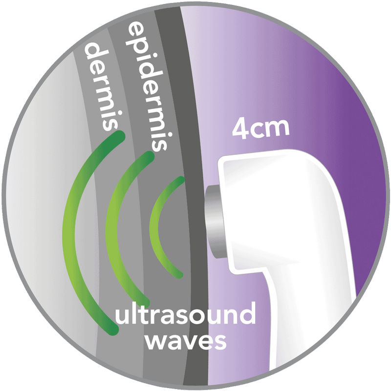 REVITIVE Ultrasound Therapy