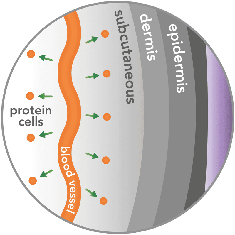 REVITIVE Ultrasound Therapy